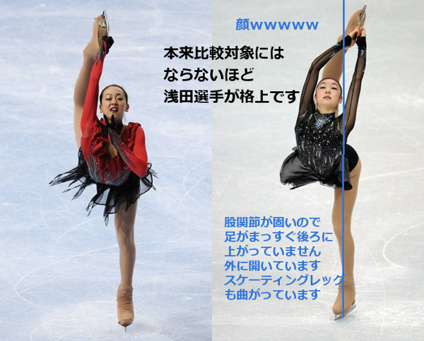 腰痛・左ヒザももう限界で…フィギュア元世界女王・浅田真央が年内にも引退へ：コメント40