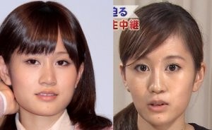 女性が感じる違和感…高須院長にジャッジしてほしい女性芸能人12人：コメント16