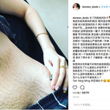 23歳のママが公開した “4つ子を出産後のお腹写真” が大きな話題に