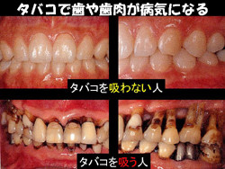 タバコとガンの関係性が無いのではと発覚：コメント74