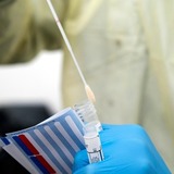 オミクロン「BA.2」派生株、重症化率高い兆候　新研究