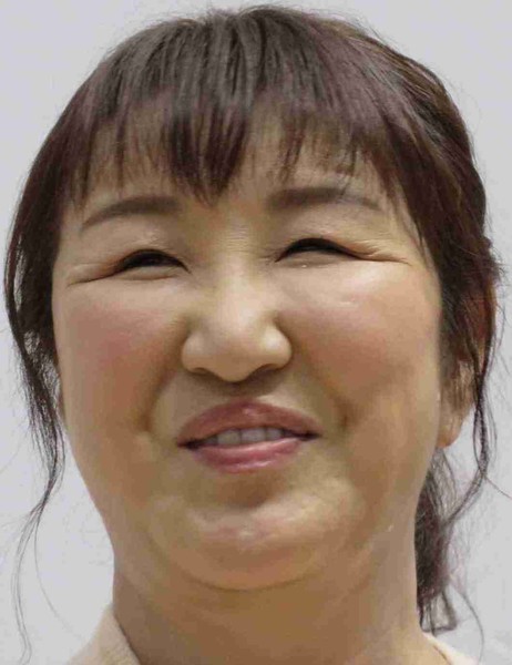 北斗晶「たまげる痛さ」帯状疱疹罹患を報告「痛いと聞いてたけど…とにかく右半分が頭から痛い」：コメント2