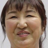 北斗晶「たまげる痛さ」帯状疱疹罹患を報告「痛いと聞いてたけど…とにかく右半分が頭から痛い」