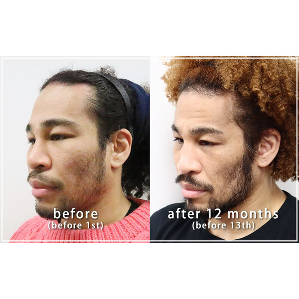 ææ¥è±ã­ã©ã©ãå®å®äººé¡ãå¼ã°ããããâè«äºâã«â¦ãå®å®äººãã´ãªã©é¡ã ã£ããå®å®äººã®æ¹ãâ¦ãï¼ã³ã¡ã³ã9